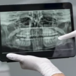 Korean Dentist Implant Cost and What Patients Can Expect