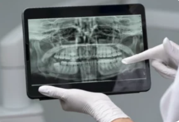 Korean Dentist Implant Cost and What Patients Can Expect