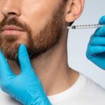 Beard Transplants: Creating Density and Definition